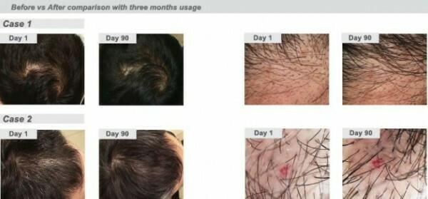 Pelo Baum Hair Revitalizing Solution 60ml