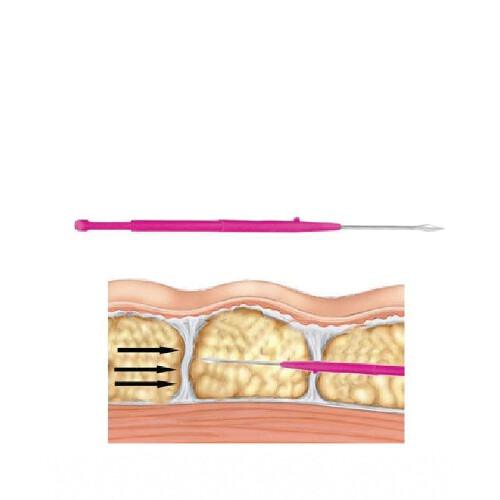CelluErase (4 packs) Lame microchirurgicale